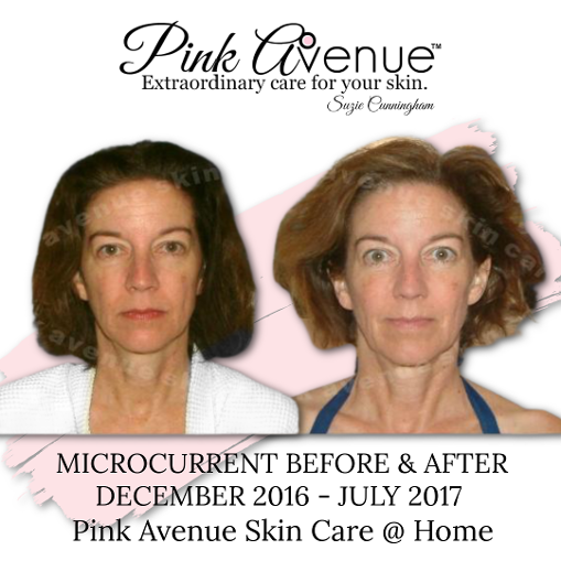 Best Micro current Facial, Pink Avenue, Toronto Canada