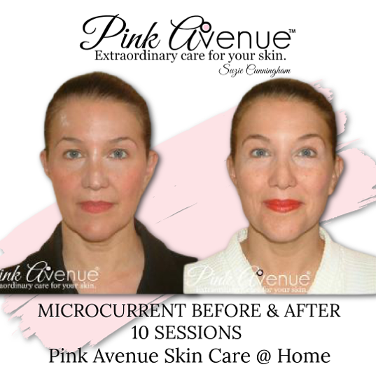 Best Micro Current Facials, Pink Avenue, Toronto Canada