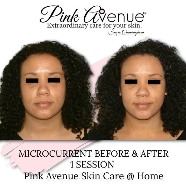Best Micro Current Facials, Pink Avenue, Toronto Canada