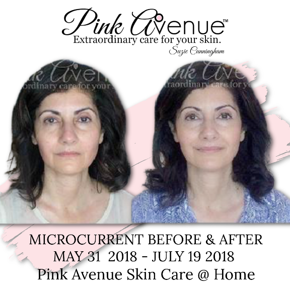 Best Micro Current Facial, Pink Avenue, Toronto, Canada